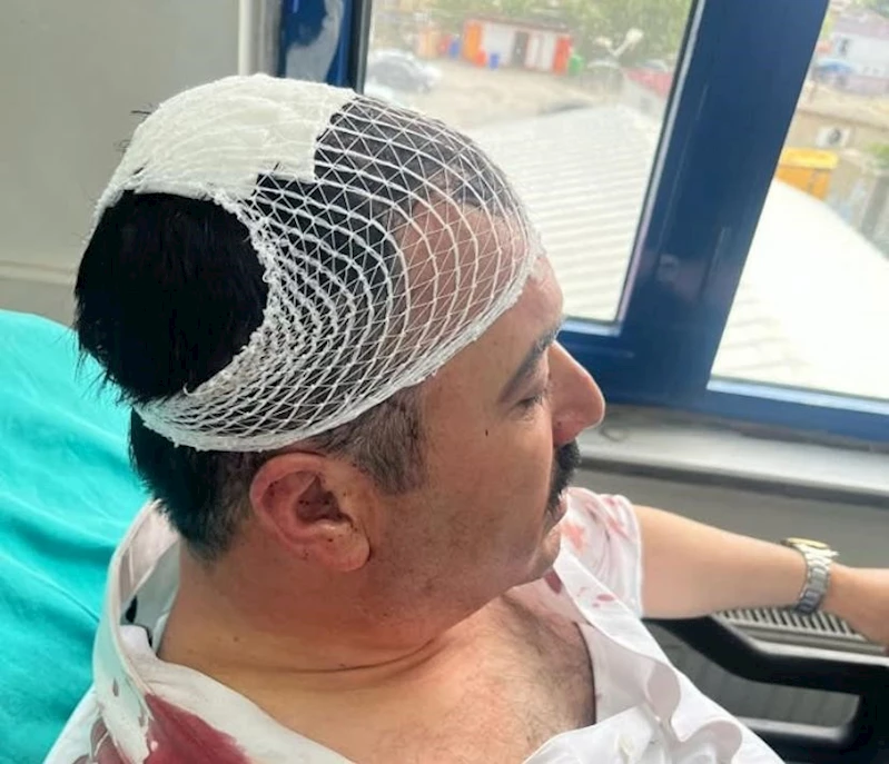 Belediye başkan yardımcısını şekerlikle yaralayan YRP’li başkan yardımcısı tutuklandı
