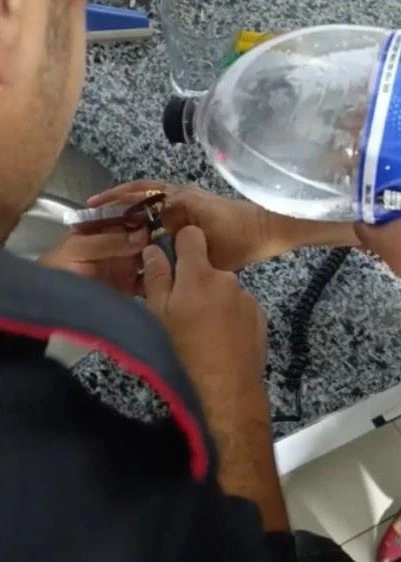 Parmağına yüzük sıkıştı, yardımına itfaiye koştu
