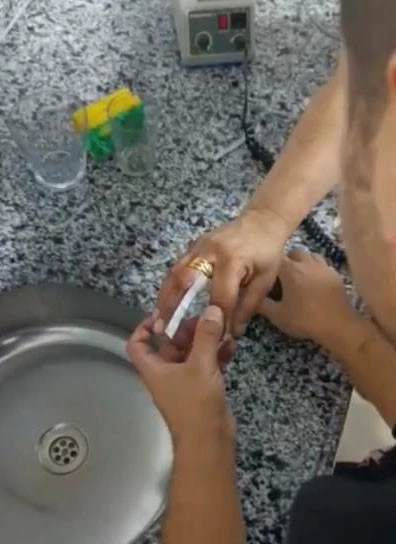 Parmağına yüzük sıkıştı, yardımına itfaiye koştu
